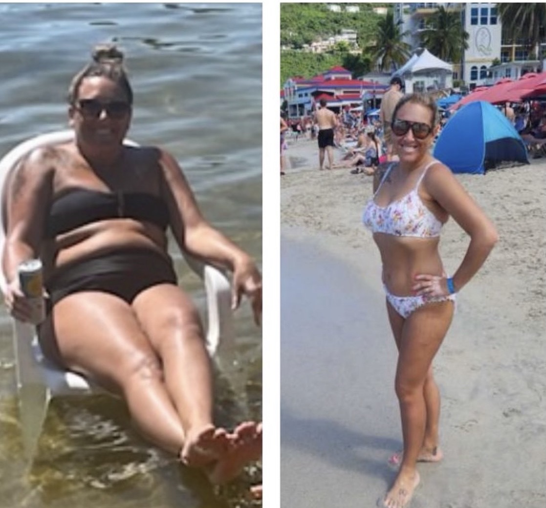 Before and after GLP-1 weight loss results at IV League Hydration in Boston — client transformation from a supervised semaglutide program