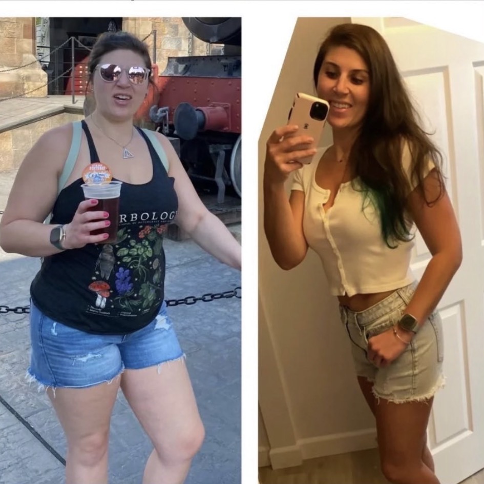 Before and after photos of a client on a medically supervised tirzepatide weight-loss program in South Boston, MA